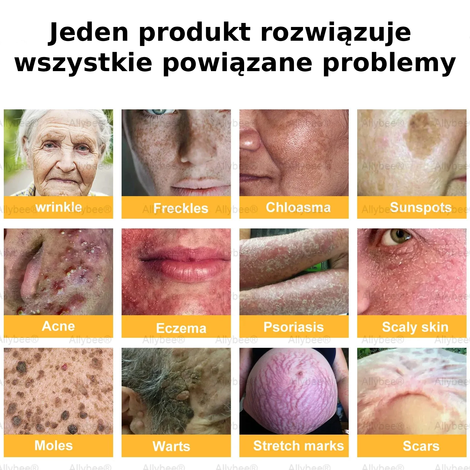 „Zakazane” odkrycie natury, które usuwa lata uszkodzeń skóry i kończy codzienną walkę z łuszczycą, zmarszczkami i przewlekłymi chorobami skóry.