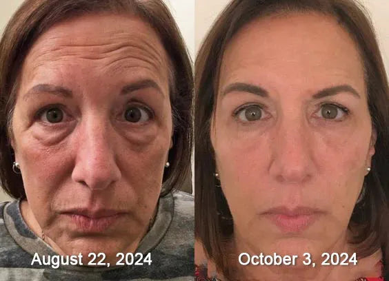 „Zakazane” odkrycie natury, które usuwa lata uszkodzeń skóry i kończy codzienną walkę z łuszczycą, zmarszczkami i przewlekłymi chorobami skóry.